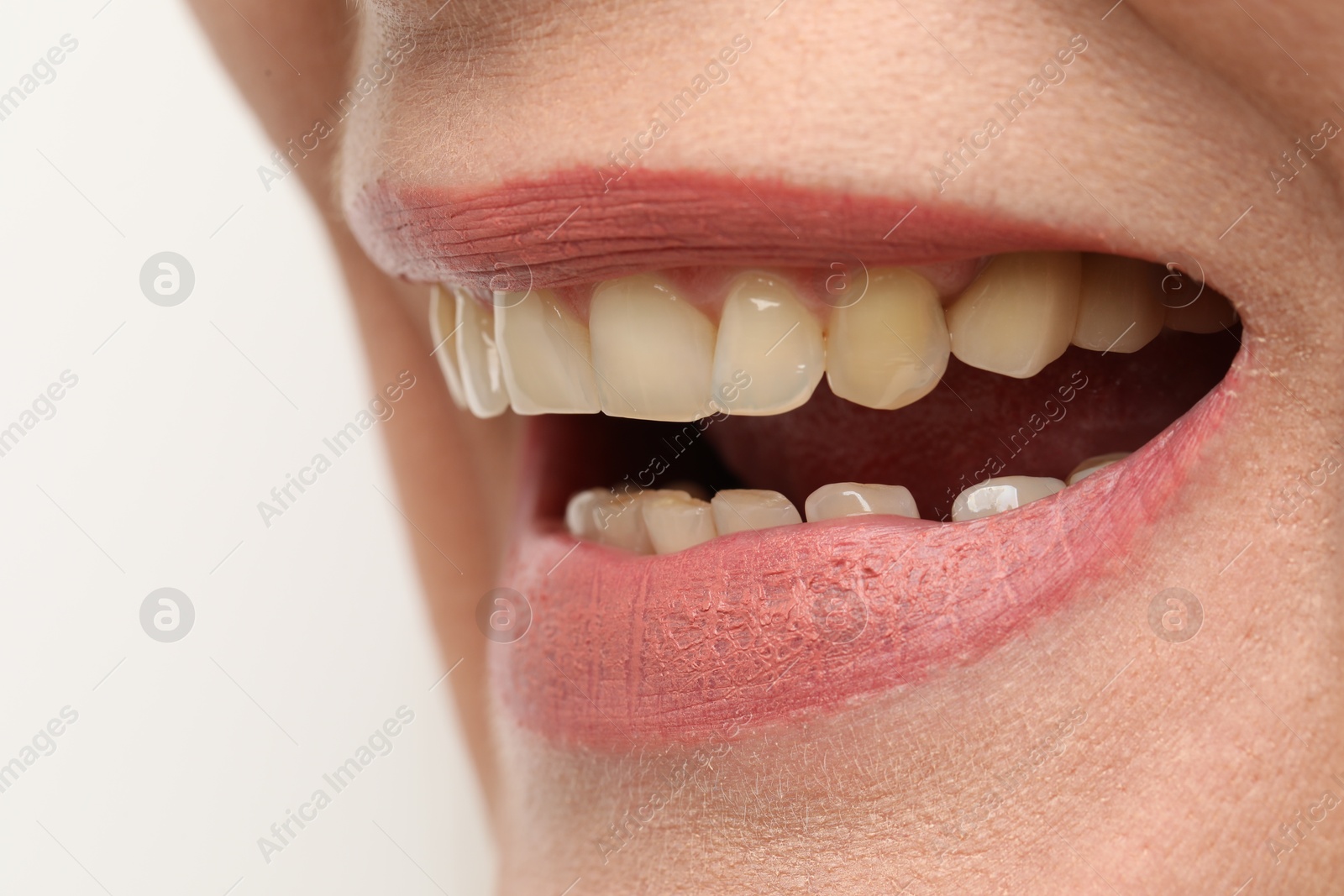 Photo of Woman smiling with her teeth on white background, closeup