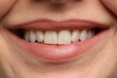 Photo of Woman smiling with her teeth, closeup view