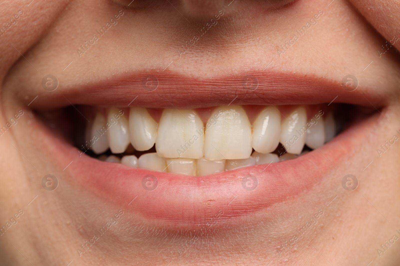 Photo of Woman smiling with her teeth, closeup view