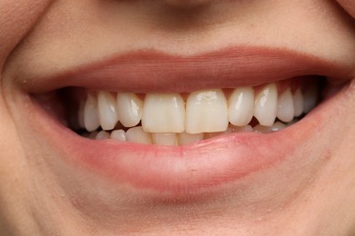 Photo of Woman smiling with her teeth, closeup view