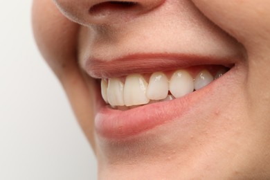 Photo of Woman smiling with her teeth on white background, closeup