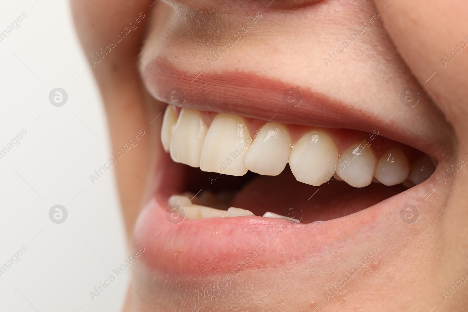 Photo of Woman smiling with her teeth on white background, closeup