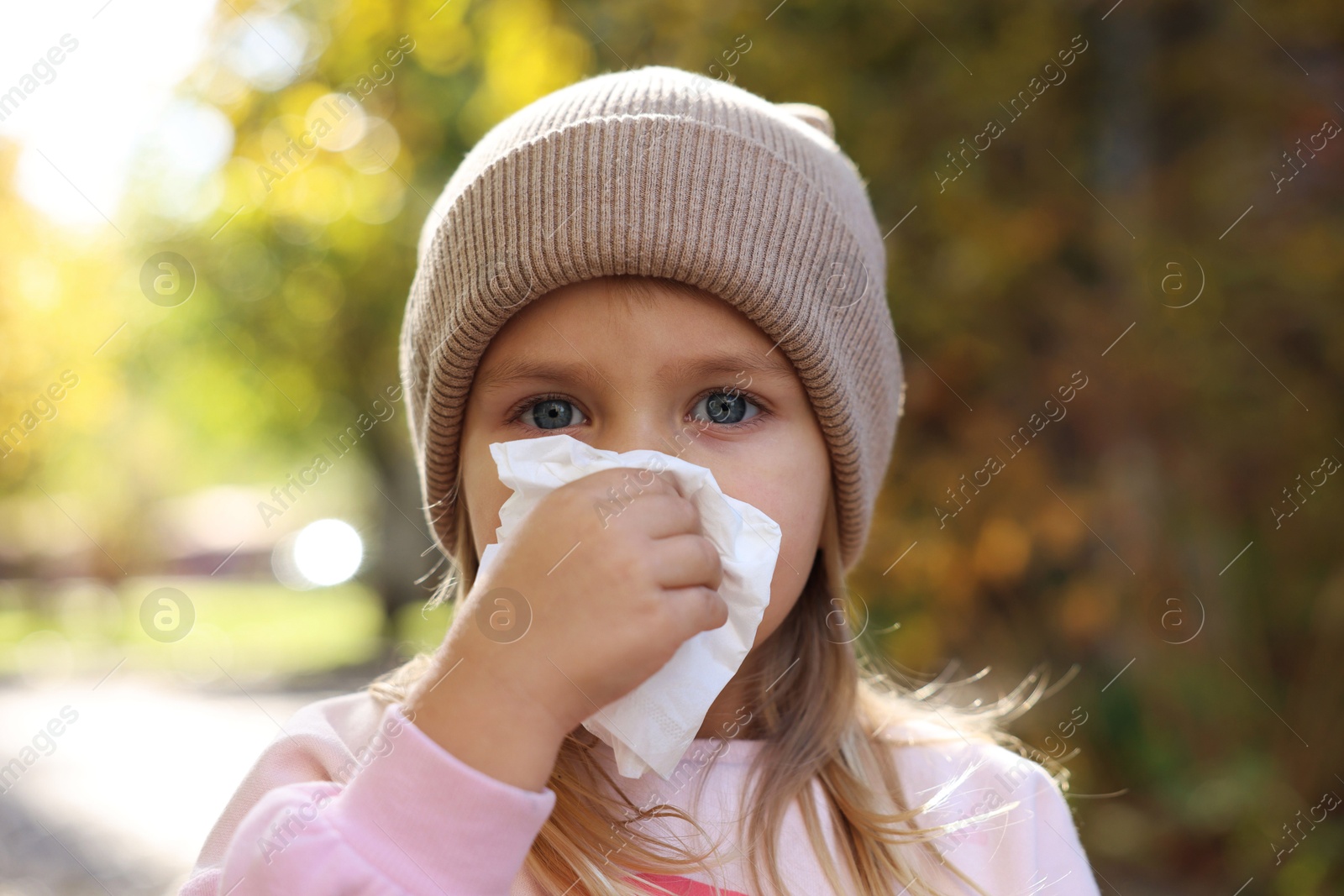 Photo of Little girl with runny nose in park