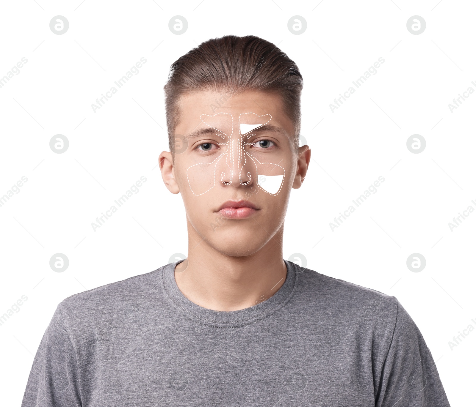 Image of Man suffering from sinusitis on white background. Illustration on his face showing disease