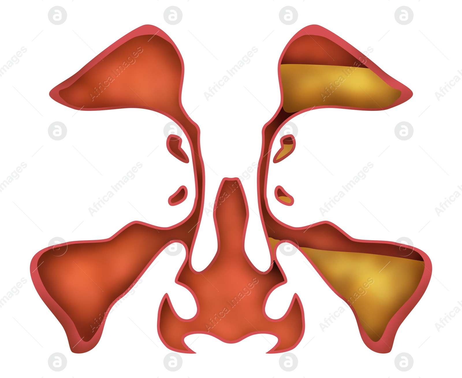 Image of Healthy and diseased sinuses, illustration on white background