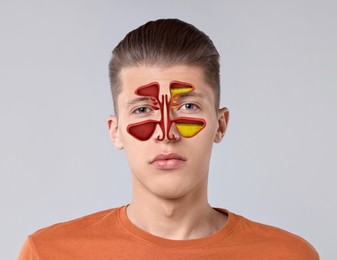 Man suffering from sinusitis on light grey background. Illustration on his face showing disease