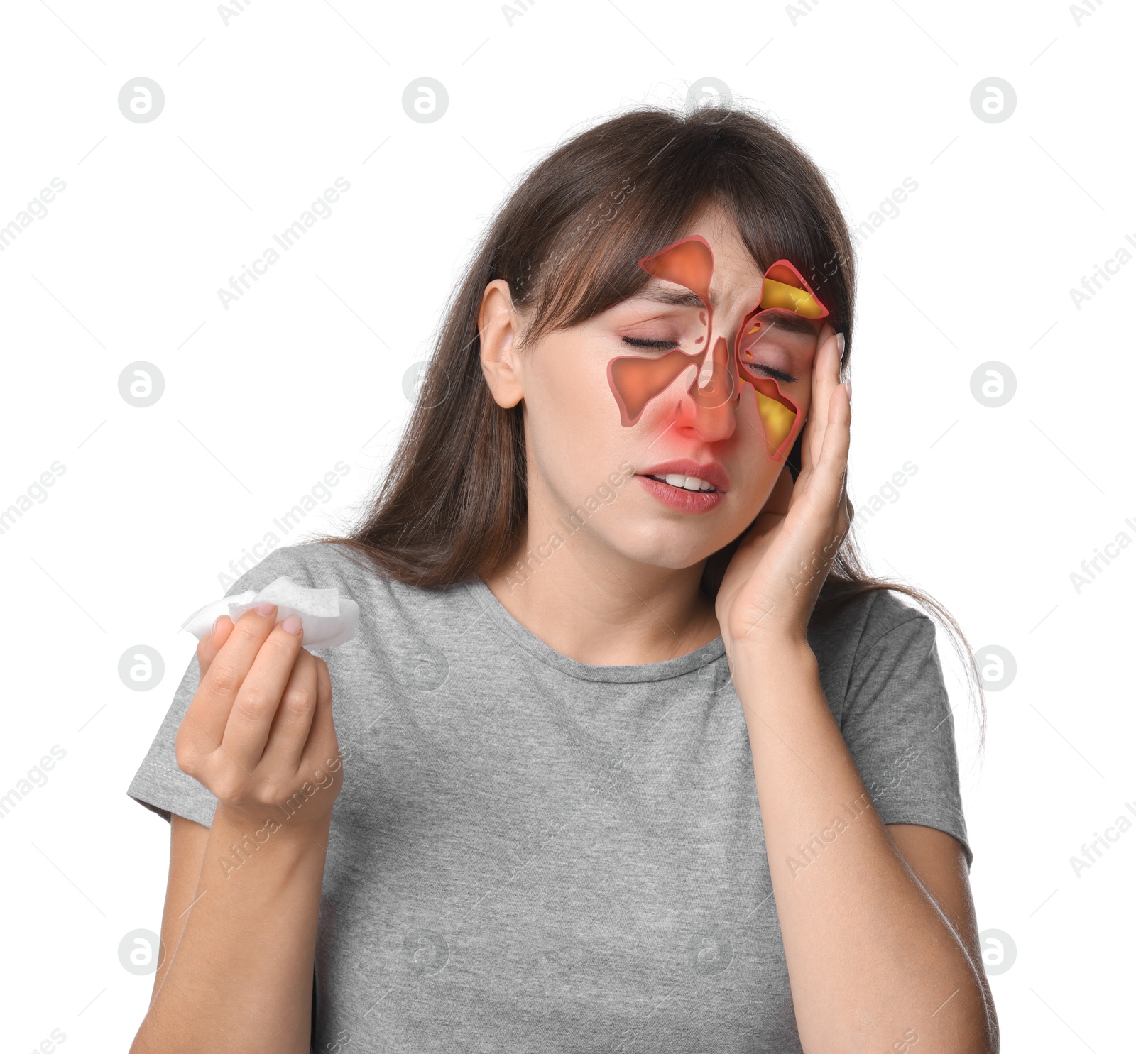 Image of Woman suffering from sinusitis on white background. Illustration on her face showing disease