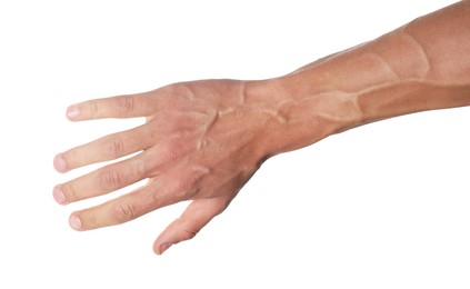 Photo of Man with bulging veins on his arm against white background, closeup