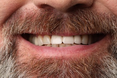 Photo of Smiling man with healthy teeth, closeup view