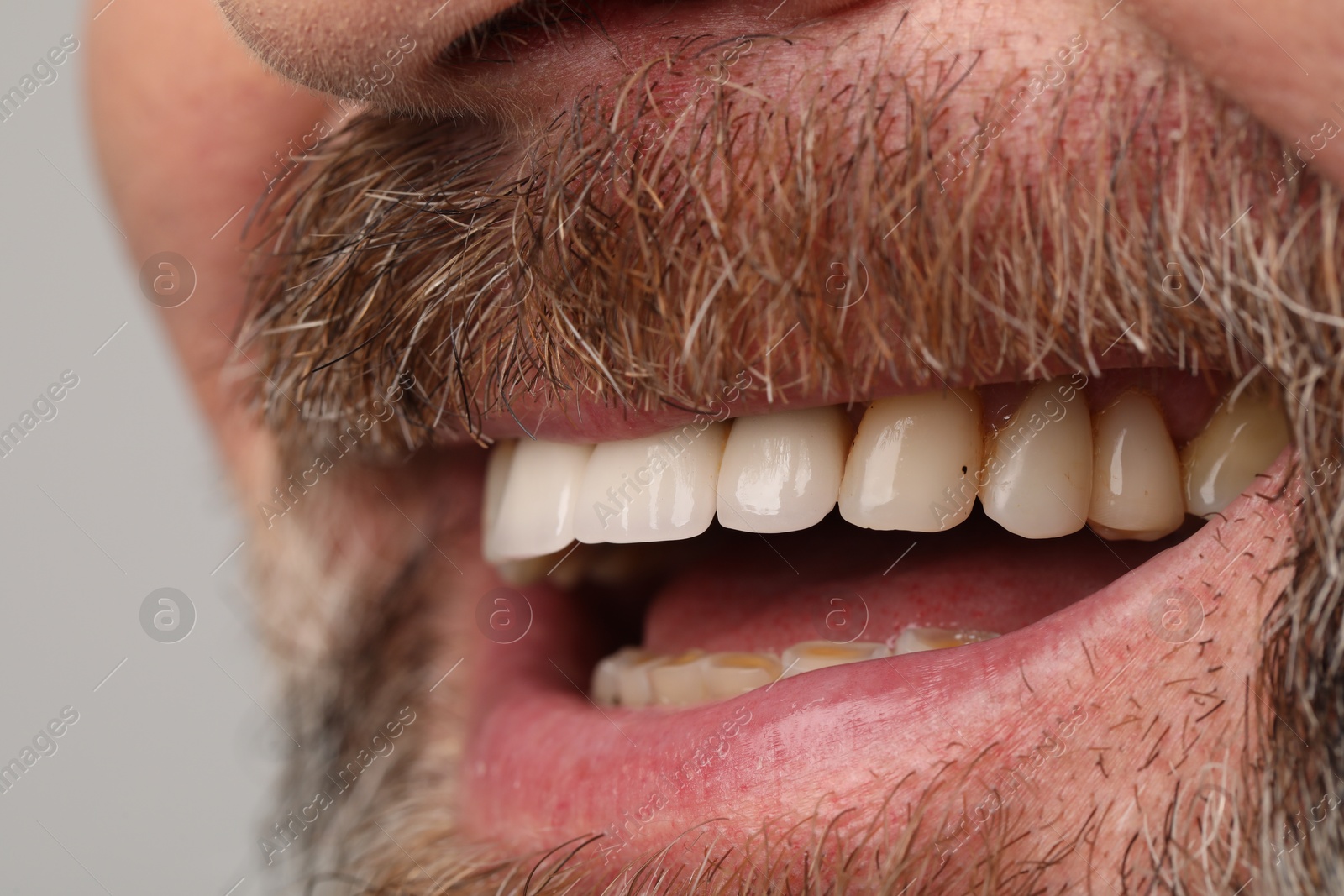 Photo of Smiling man with healthy teeth on light background, closeup view