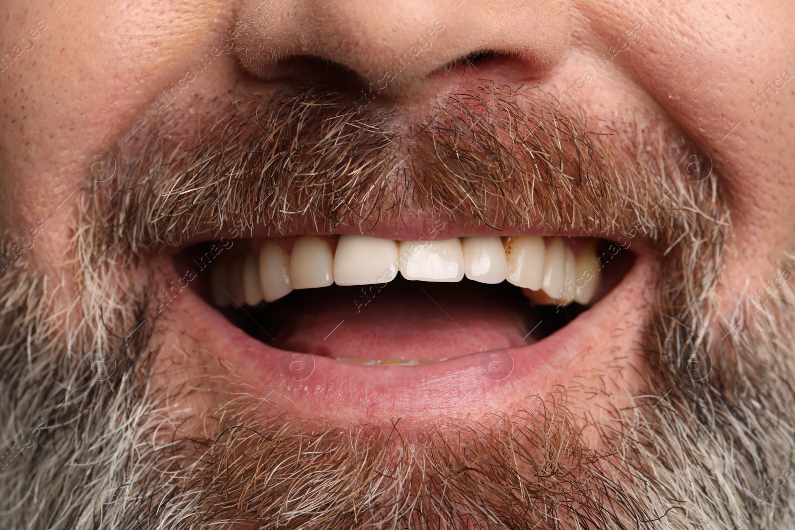 Photo of Smiling man with healthy teeth, closeup view