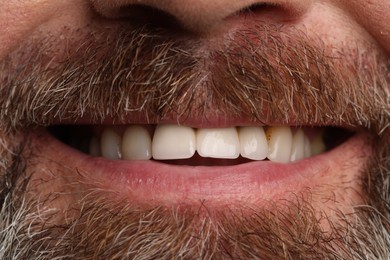 Photo of Smiling man with healthy teeth, closeup view