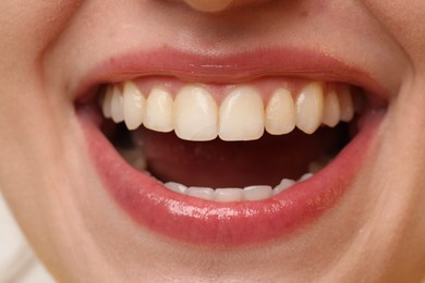 Smiling woman with healthy teeth on light background, closeup view