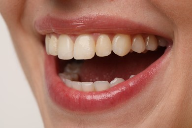 Smiling woman with healthy teeth on light background, closeup view