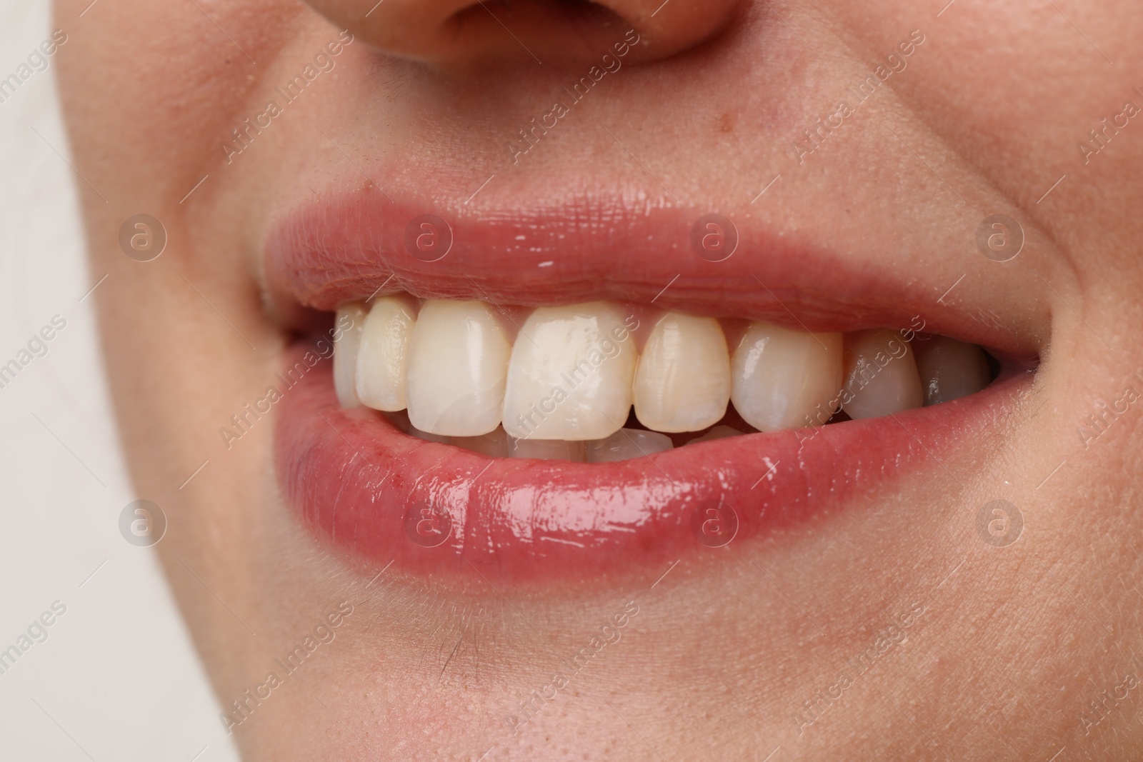 Photo of Smiling woman with healthy teeth on light background, closeup view