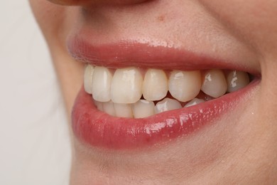 Photo of Smiling woman with healthy teeth on light background, closeup view