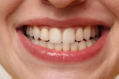 Photo of Smiling woman with healthy teeth, closeup view