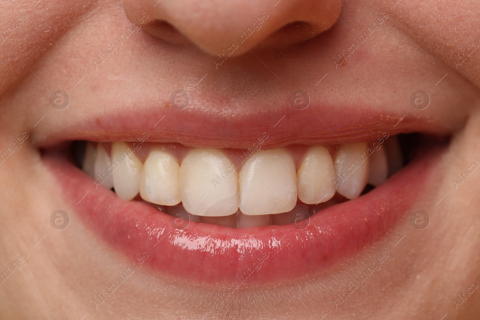 Photo of Smiling woman with healthy teeth, closeup view