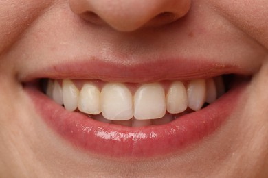 Smiling woman with healthy teeth, closeup view