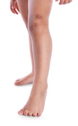 Photo of Child with bruise on leg against white background, closeup