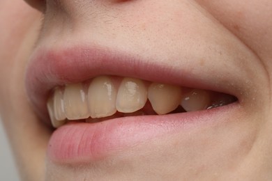 Photo of Woman smiling with her teeth, closeup view