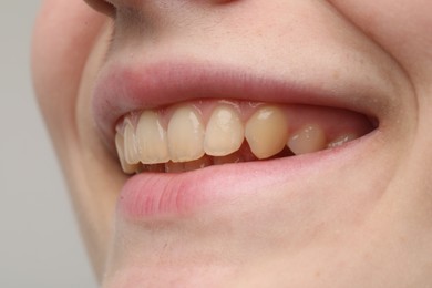 Photo of Woman smiling with her teeth on light grey background, closeup