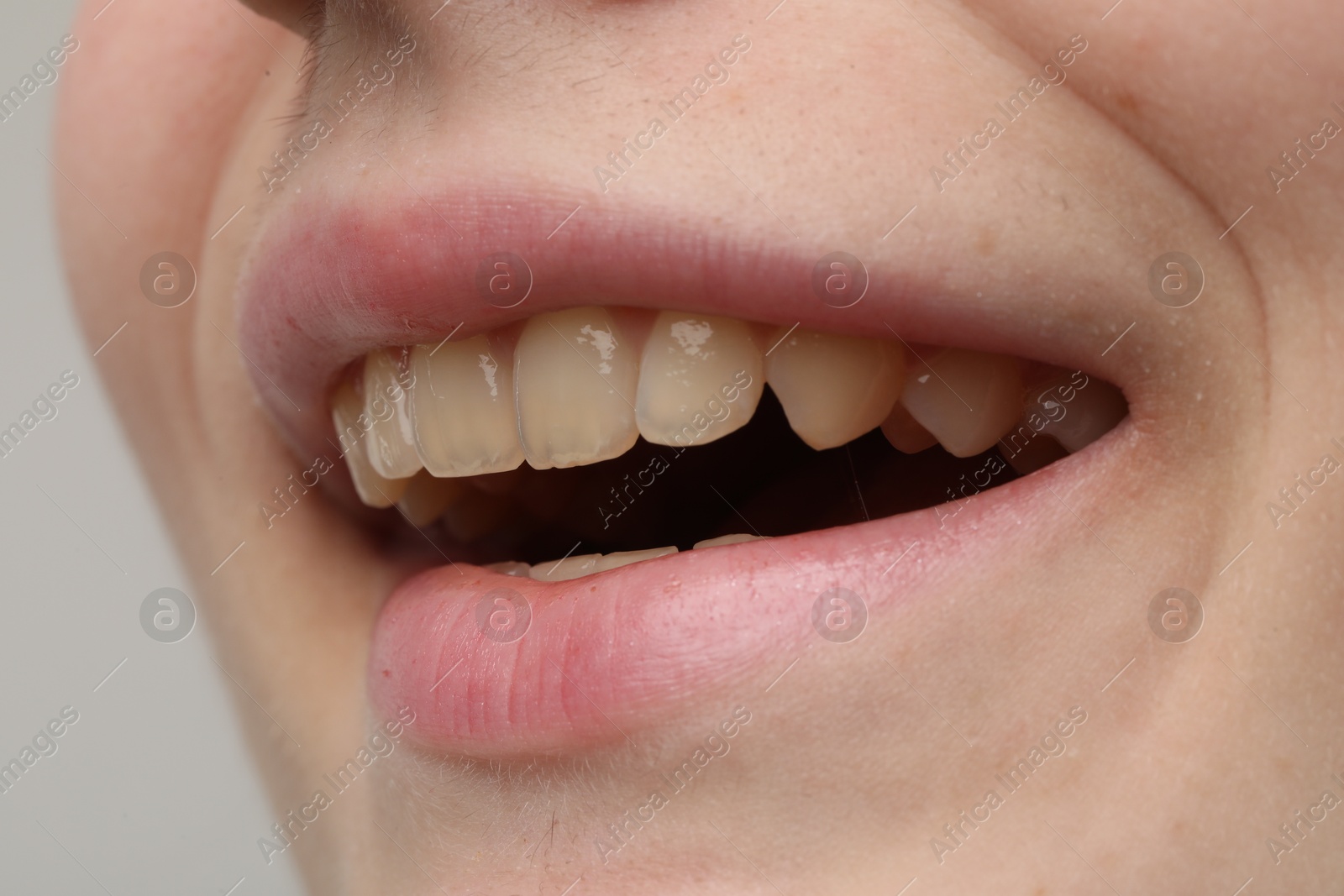 Photo of Woman smiling with her teeth on light grey background, closeup