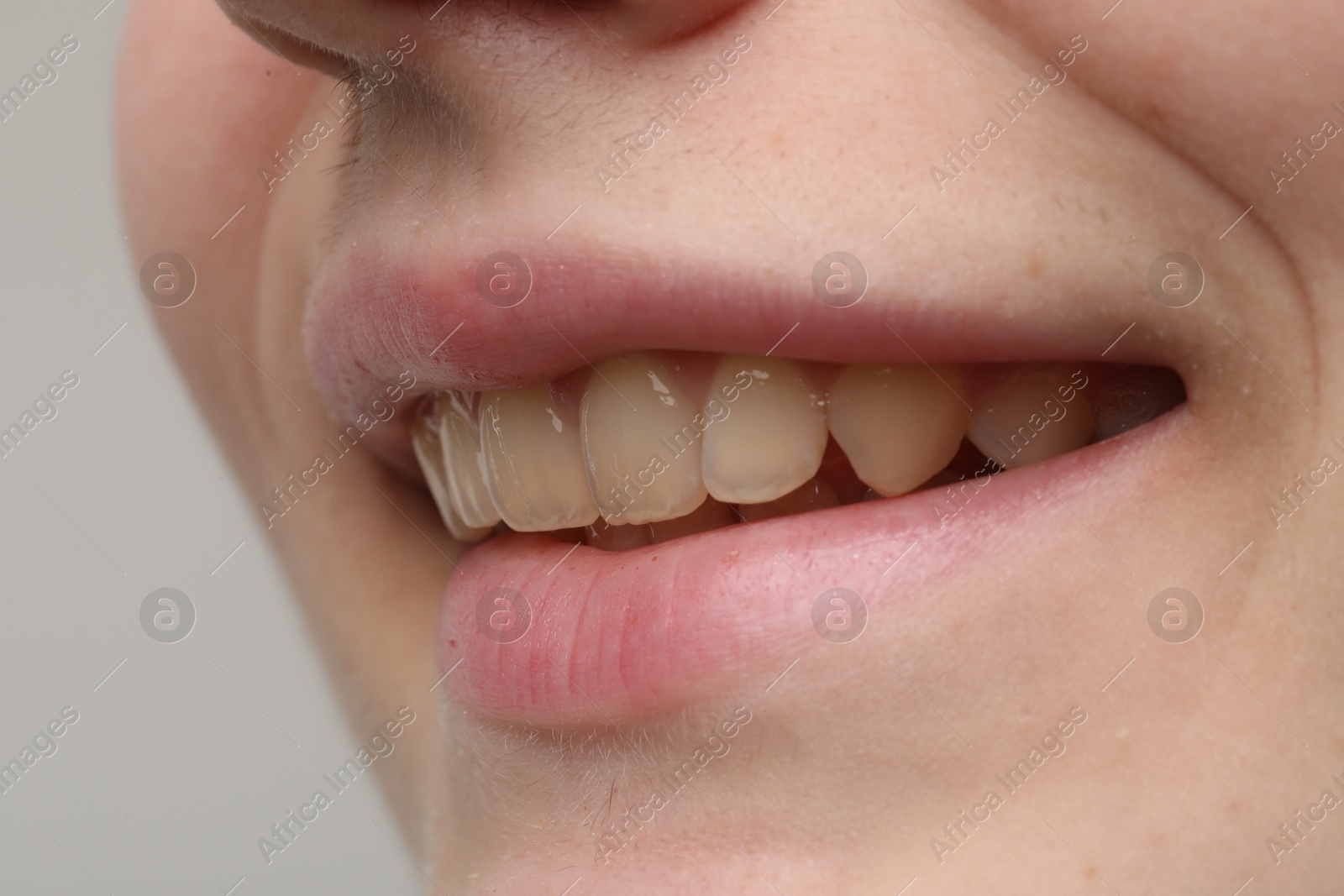 Photo of Woman smiling with her teeth on light grey background, closeup