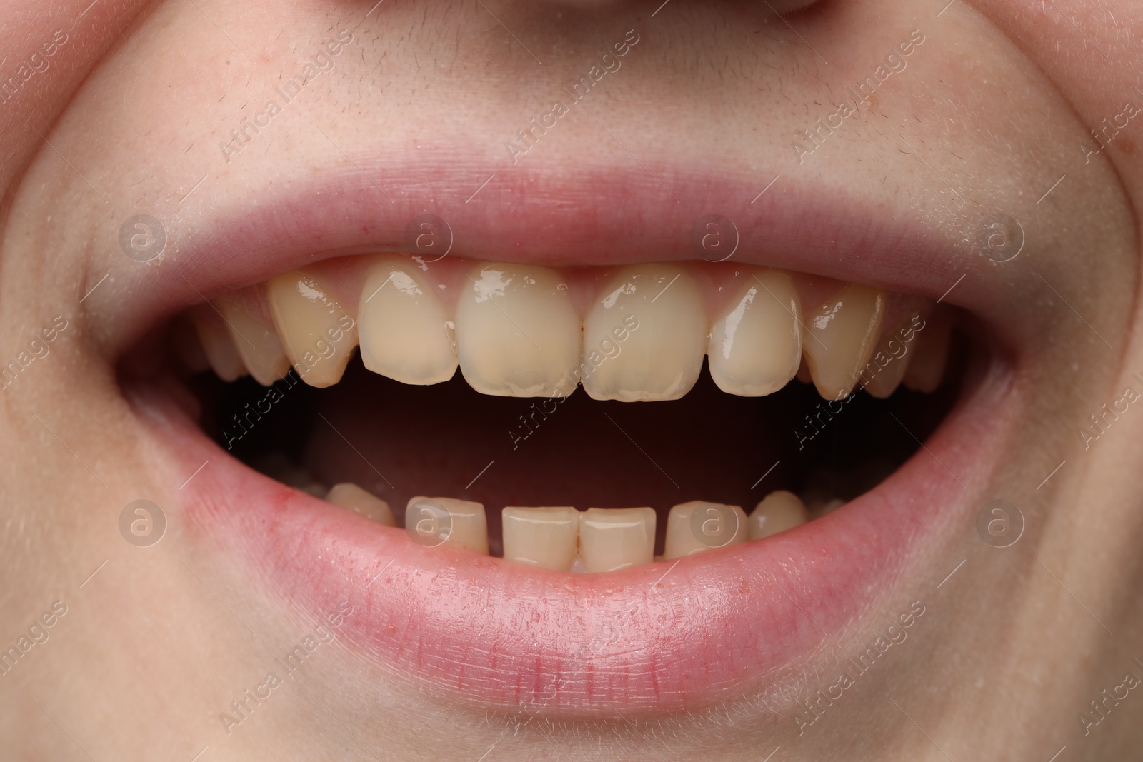 Photo of Woman smiling with her teeth, closeup view