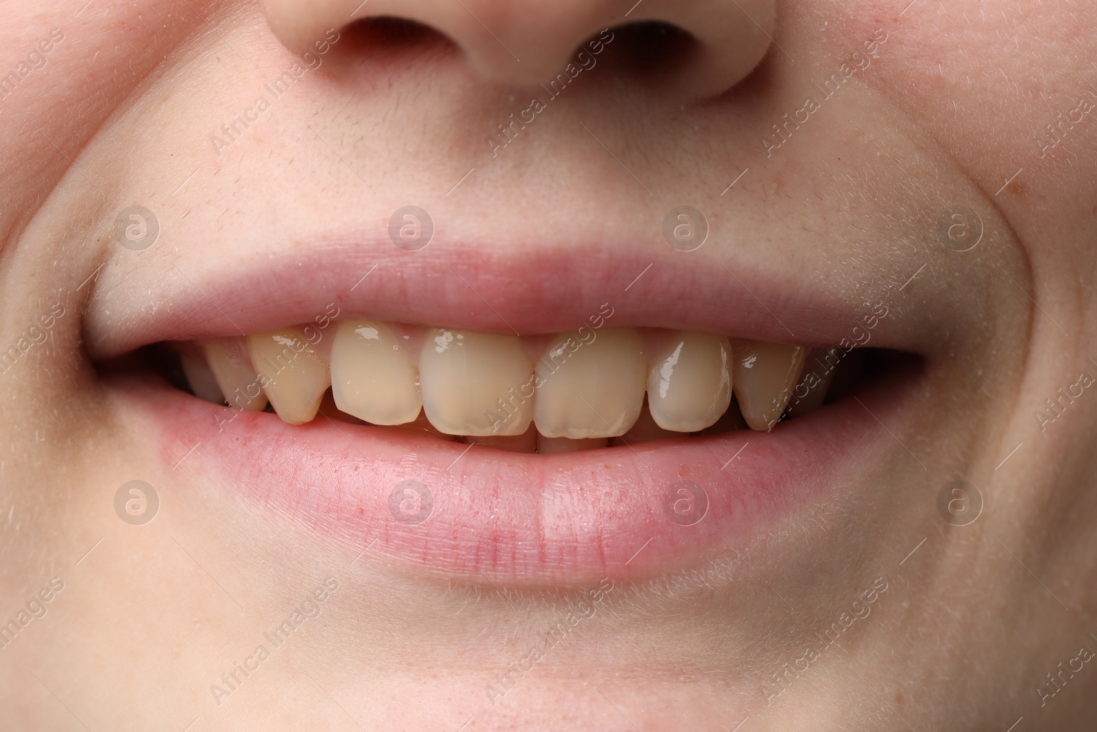 Photo of Woman smiling with her teeth, closeup view