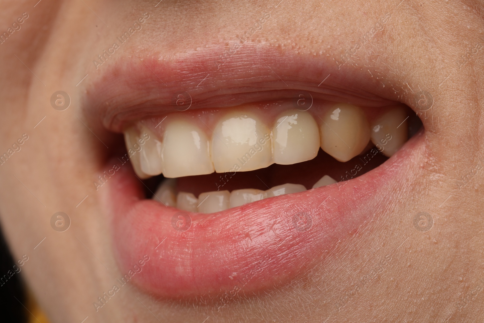 Photo of Woman smiling with her teeth, closeup view