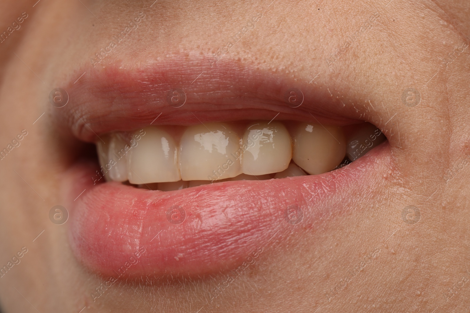 Photo of Woman smiling with her teeth, closeup view