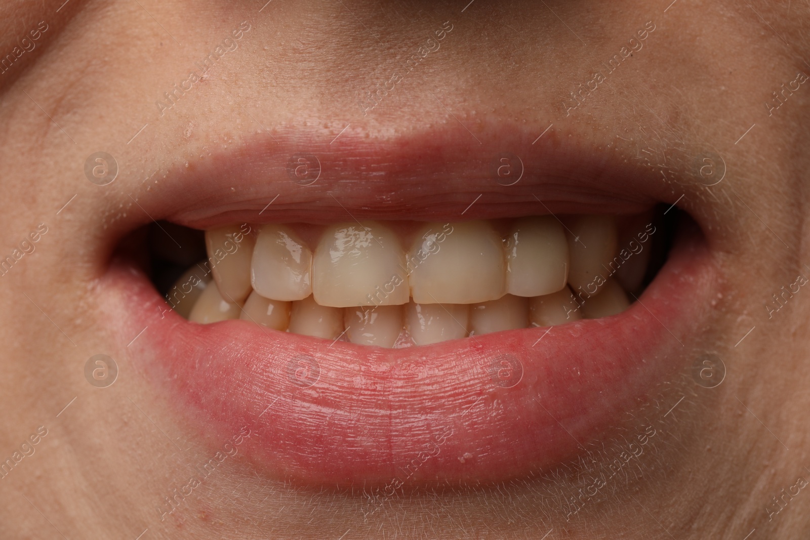 Photo of Woman smiling with her teeth, closeup view