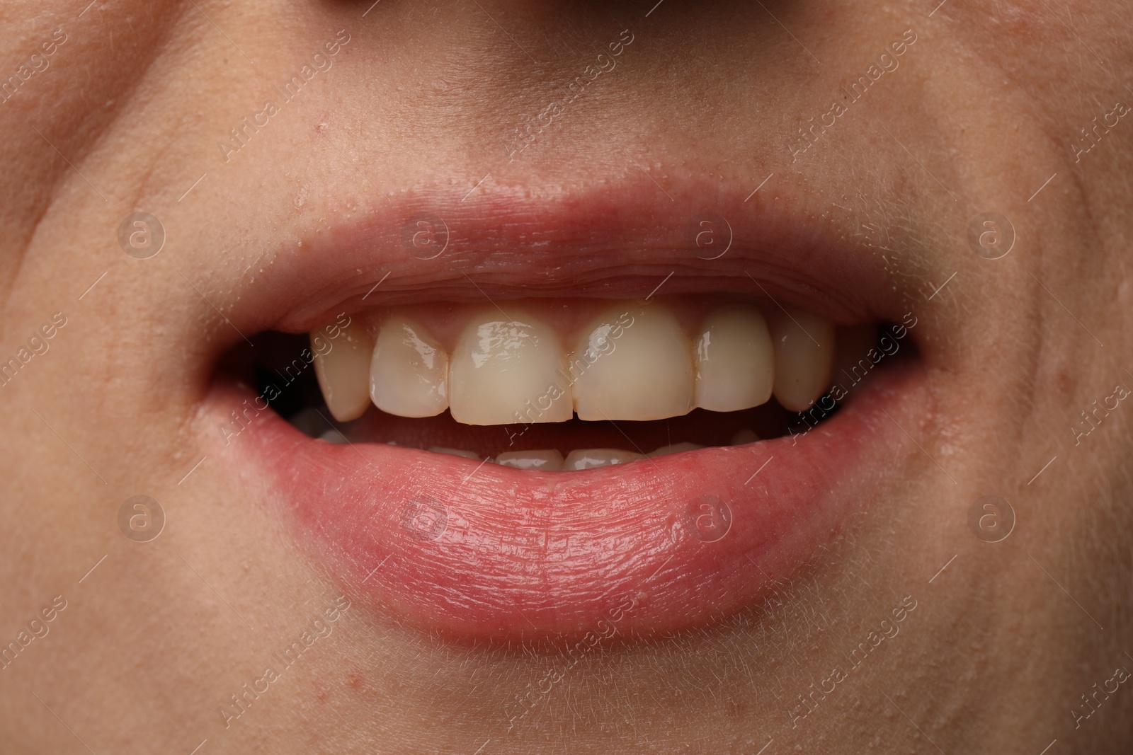 Photo of Woman smiling with her teeth, closeup view