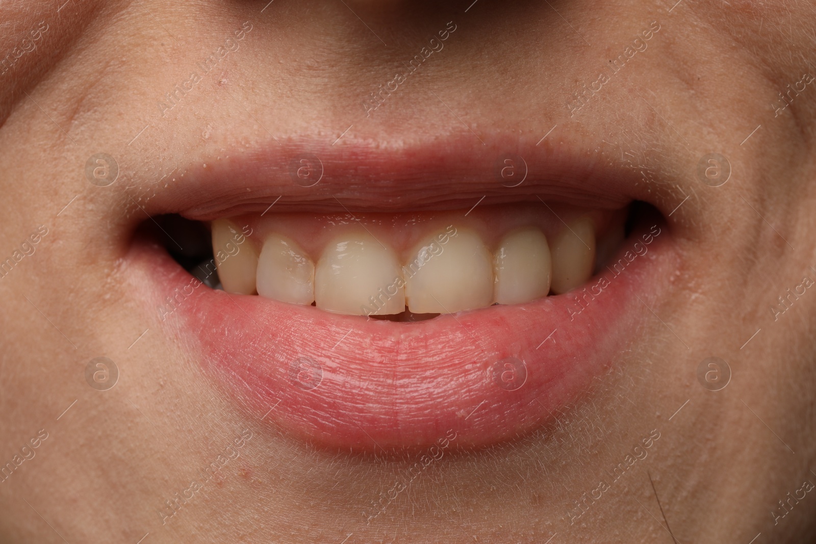 Photo of Woman smiling with her teeth, closeup view