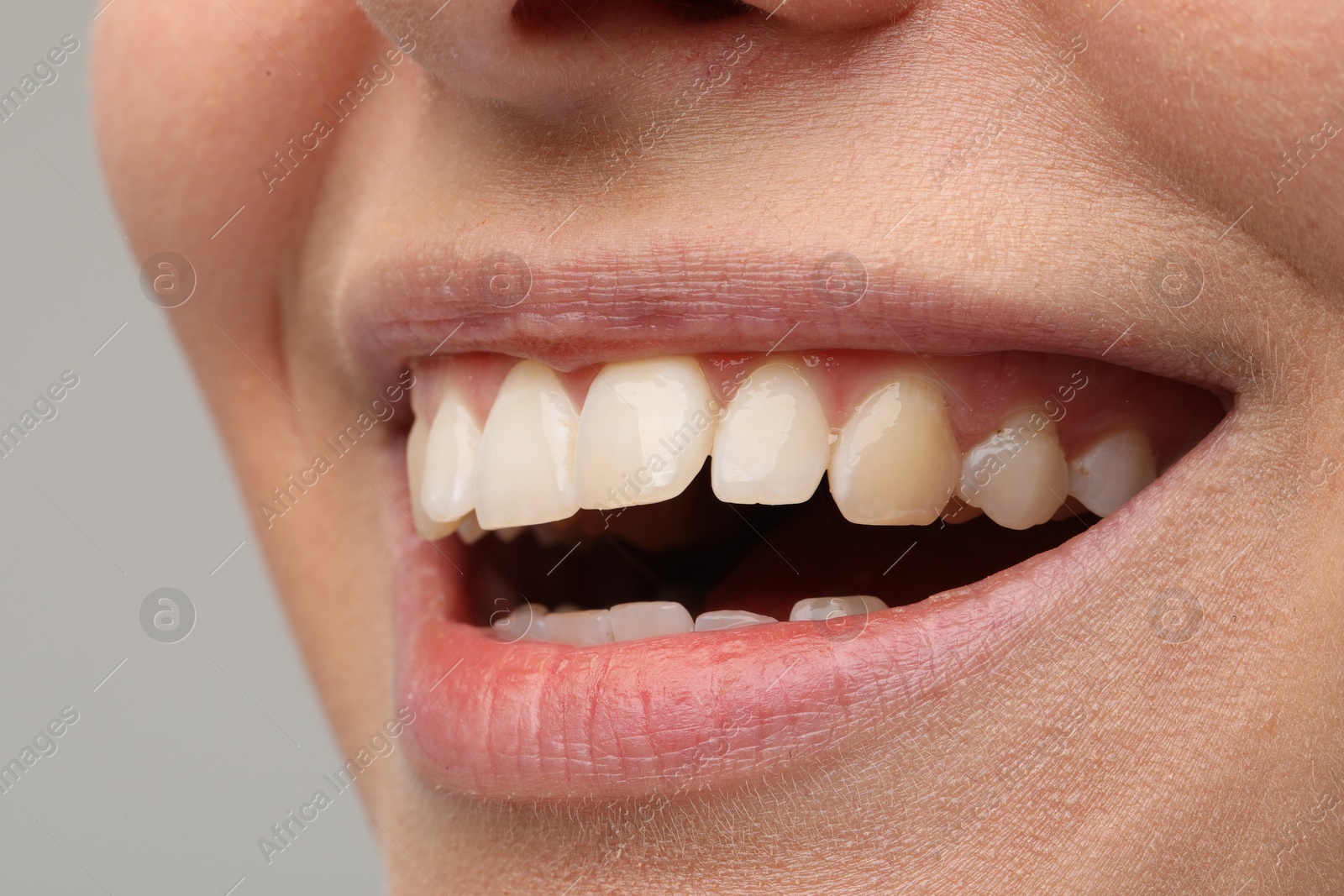 Photo of Smiling woman with healthy teeth on light grey background, closeup