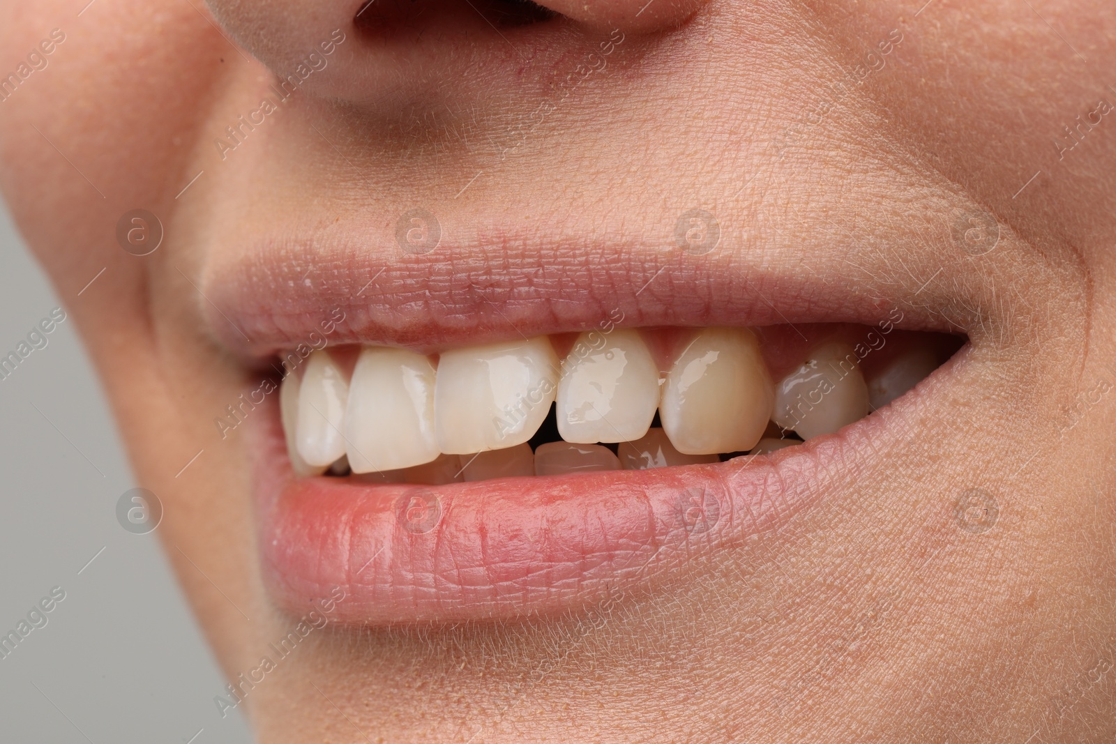 Photo of Smiling woman with healthy teeth on light grey background, closeup