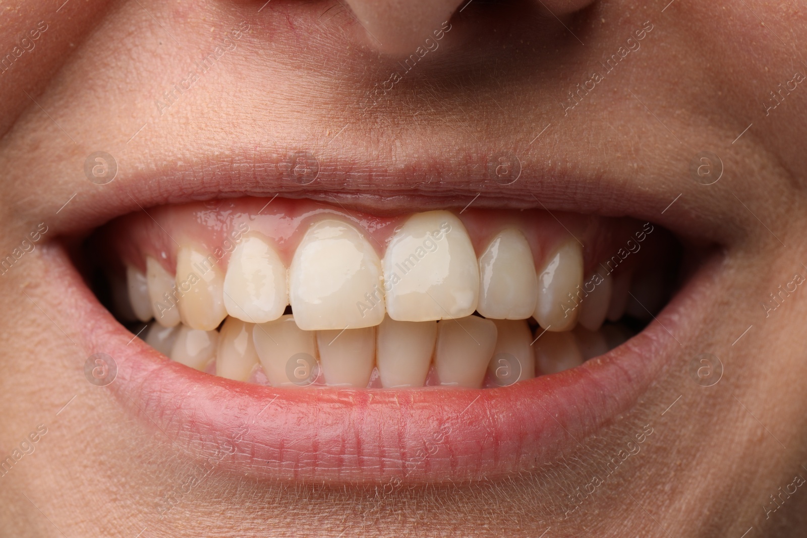 Photo of Smiling woman with healthy teeth, closeup view