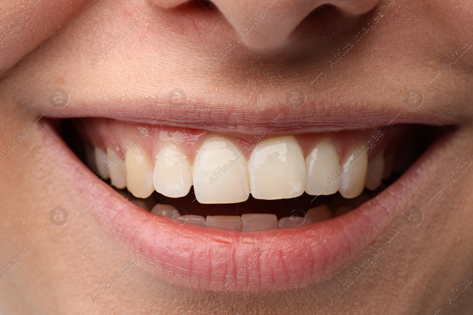 Photo of Smiling woman with healthy teeth, closeup view