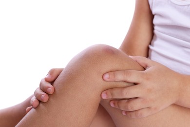 Photo of Child with bruise on leg against white background, closeup