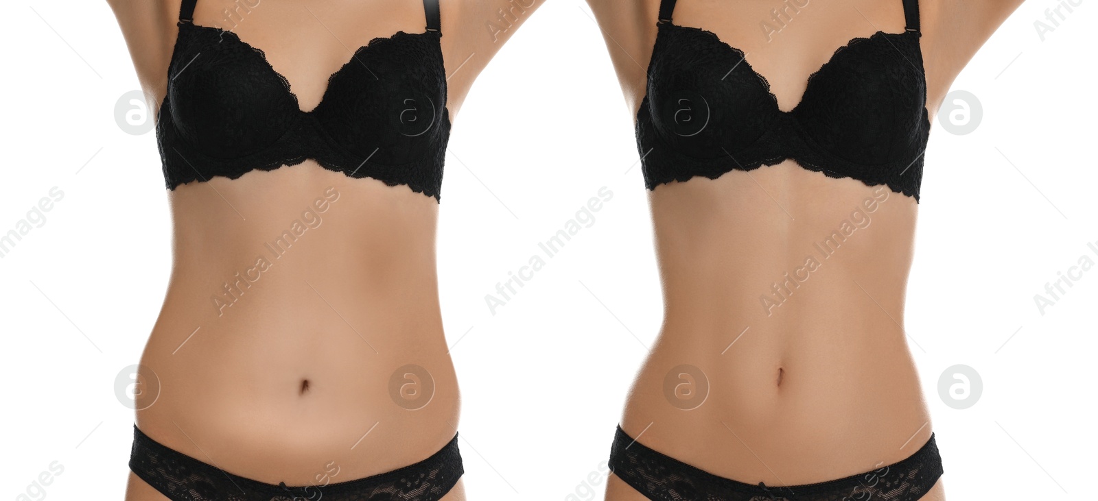 Image of Woman showing her belly with excess fat on one side and slim on other, closeup. Collage with photos before and after weight loss on white background