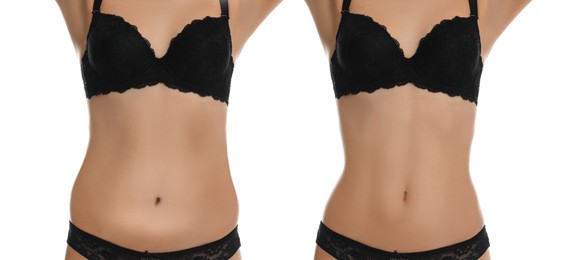 Image of Woman showing her belly with excess fat on one side and slim on other, closeup. Collage with photos before and after weight loss on white background