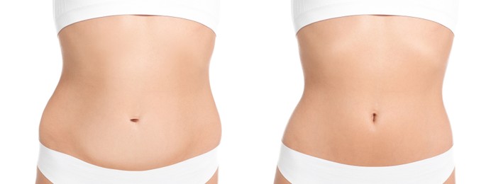 Image of Woman showing her belly with excess fat on one side and slim on other, closeup. Collage with photos before and after weight loss on white background