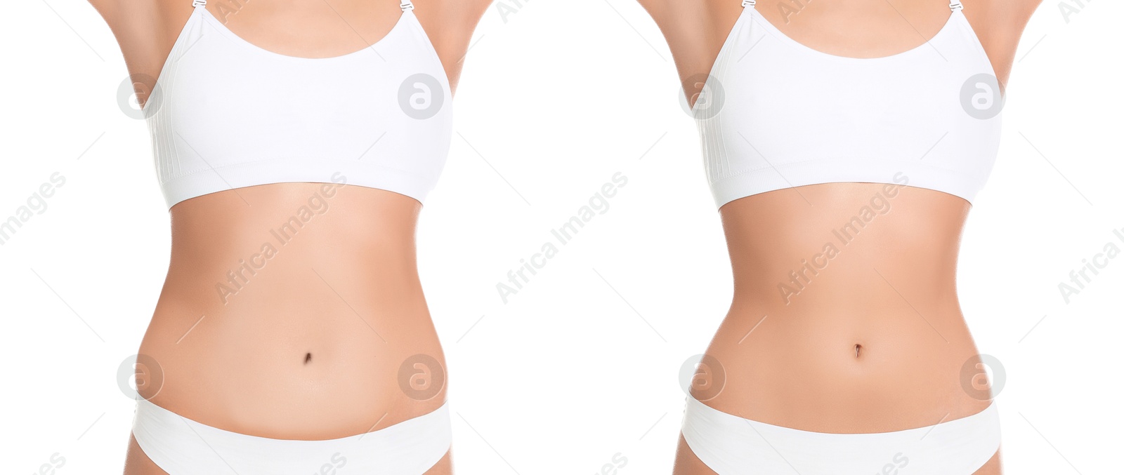 Image of Woman showing her belly with excess fat on one side and slim on other, closeup. Collage with photos before and after weight loss on white background