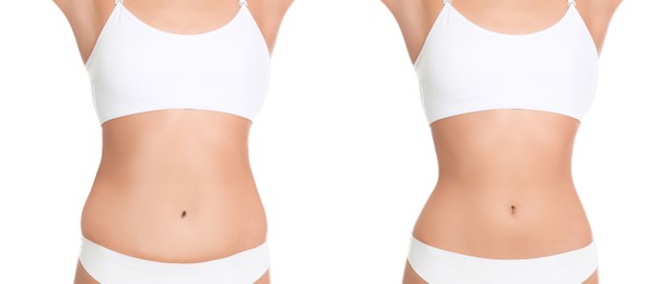 Image of Woman showing her belly with excess fat on one side and slim on other, closeup. Collage with photos before and after weight loss on white background