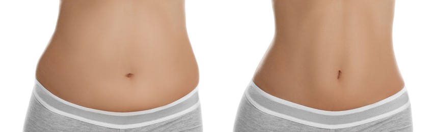 Image of Woman showing her belly with excess fat on one side and slim on other, closeup. Collage with photos before and after weight loss on white background