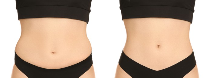 Image of Woman showing her belly with excess fat on one side and slim on other, closeup. Collage with photos before and after weight loss on white background