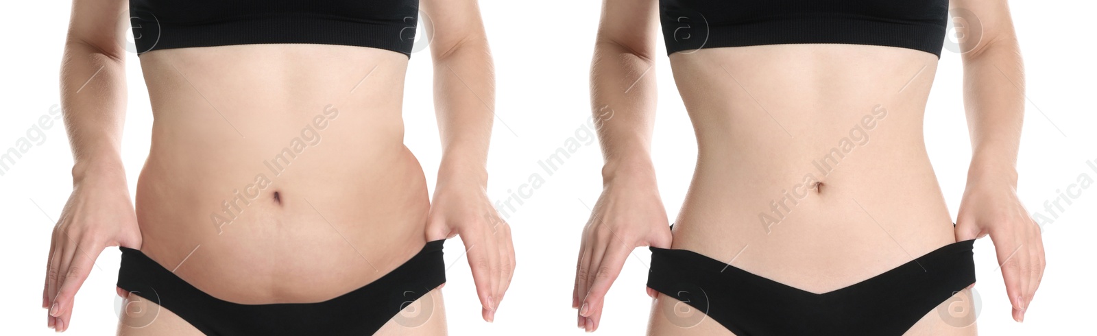 Image of Woman showing her belly with excess fat on one side and slim on other, closeup. Collage with photos before and after weight loss on white background