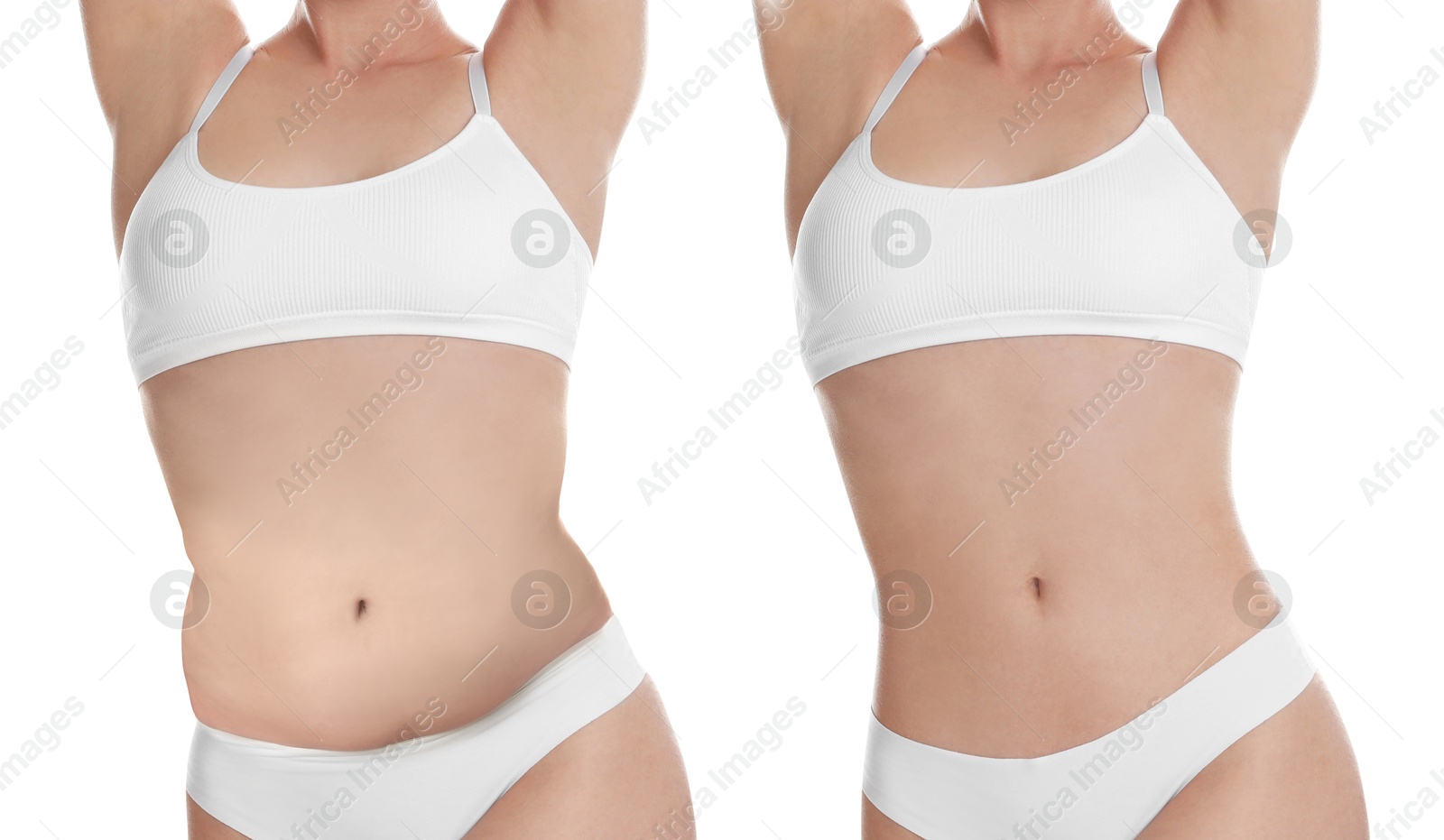 Image of Woman showing her belly with excess fat on one side and slim on other, closeup. Collage with photos before and after weight loss on white background