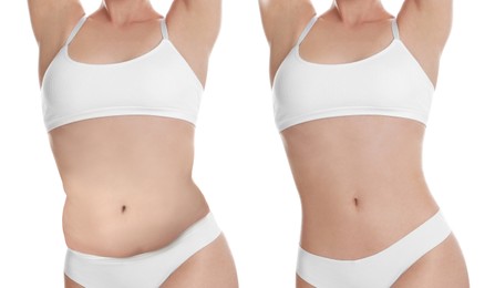 Image of Woman showing her belly with excess fat on one side and slim on other, closeup. Collage with photos before and after weight loss on white background